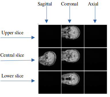Selected Slices Image